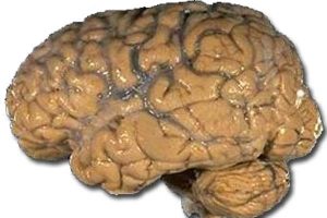 Fiskeolie øger hjernens størrelse og beskytter mod Alzheimers.  Foto:  Hjernen - NIH Wikipedia