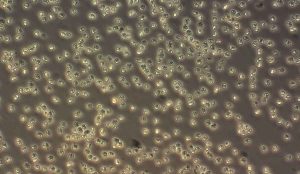 Mens vilde fisk frit kan svømme væk fra skadelige alger, er opdrætsfisk fanget i netbure og dermed langt mere sårbare, når algerne blomstrer i havet. Netop dét er årsagen til, at mange tusinde laks i de seneste uger er døde i opdrætsanlæg i det nordlige Norge. foto: hi.no