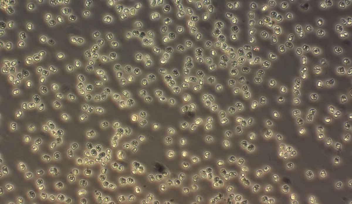 Read more about the article Derfor dør opdrætsfisken, når algerne blomstrer op