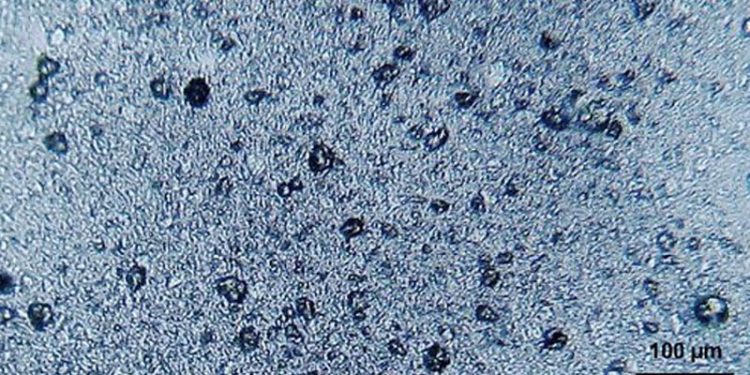 Forskere har fundet mikroplast i Norskehavet  Foto: Mikroplast - Wikipedia