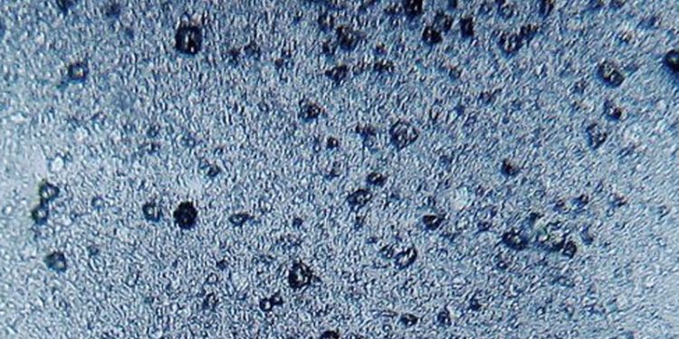 Mikroplast har en uheldig indvirken på fisk´s hjerner  Foto: Mikroplast - Wikipedia